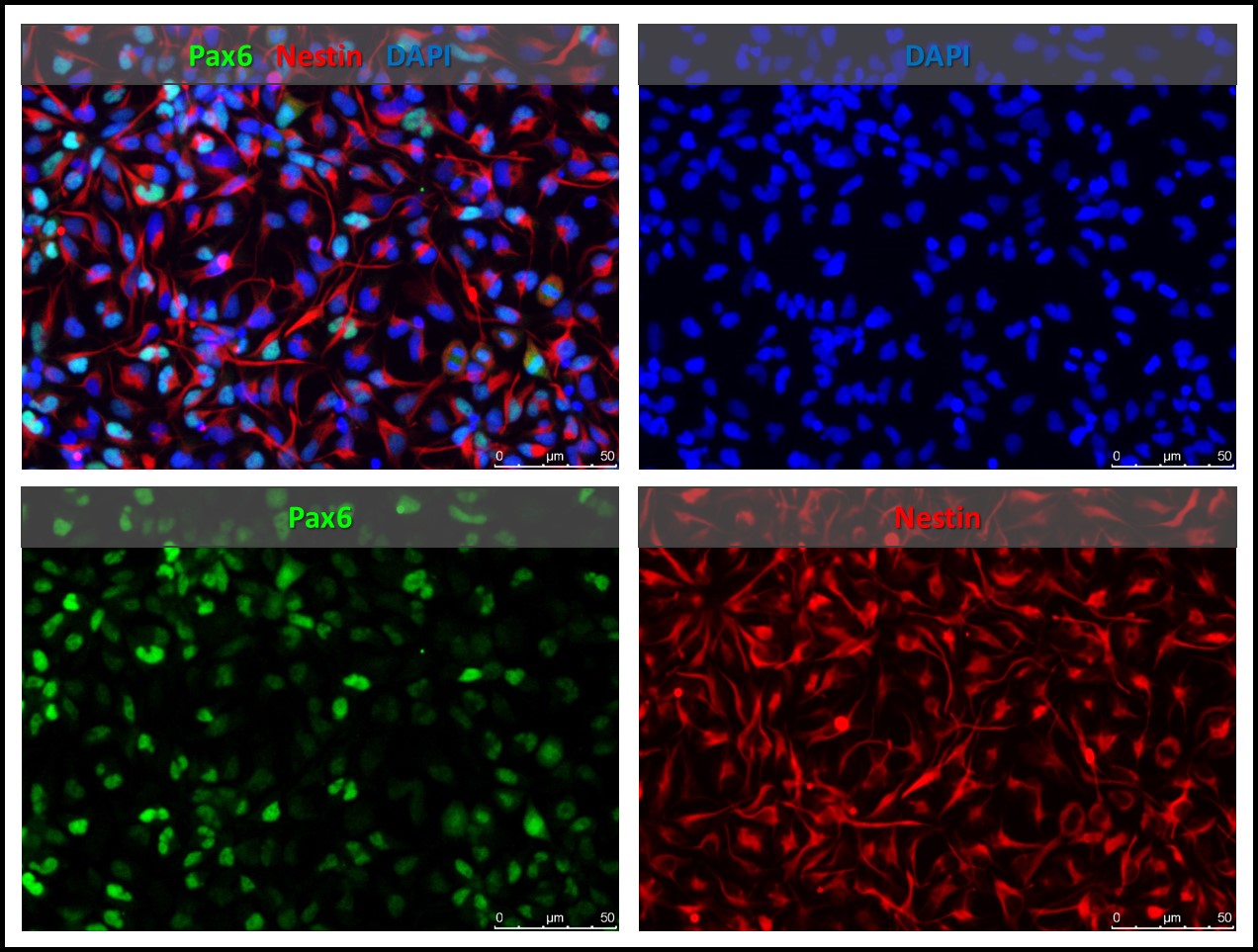 Human Neural Stem Cells Ipsc Derived Normal